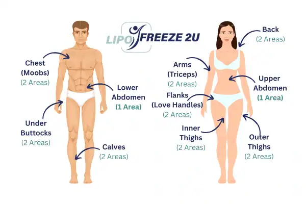 Areas you can have fat freezing treatment South Yorkshire