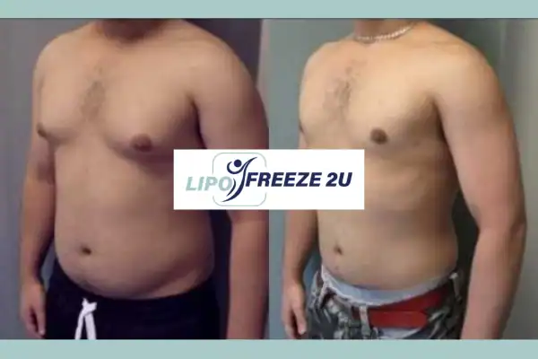 How Long Does It Take to See Results South Yorkshire?