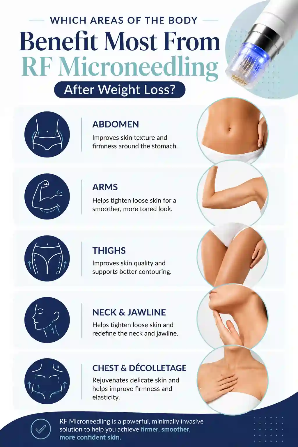 Which Areas of the Body Benefit Most From RF Microneedling After Weight Loss South Yorkshire